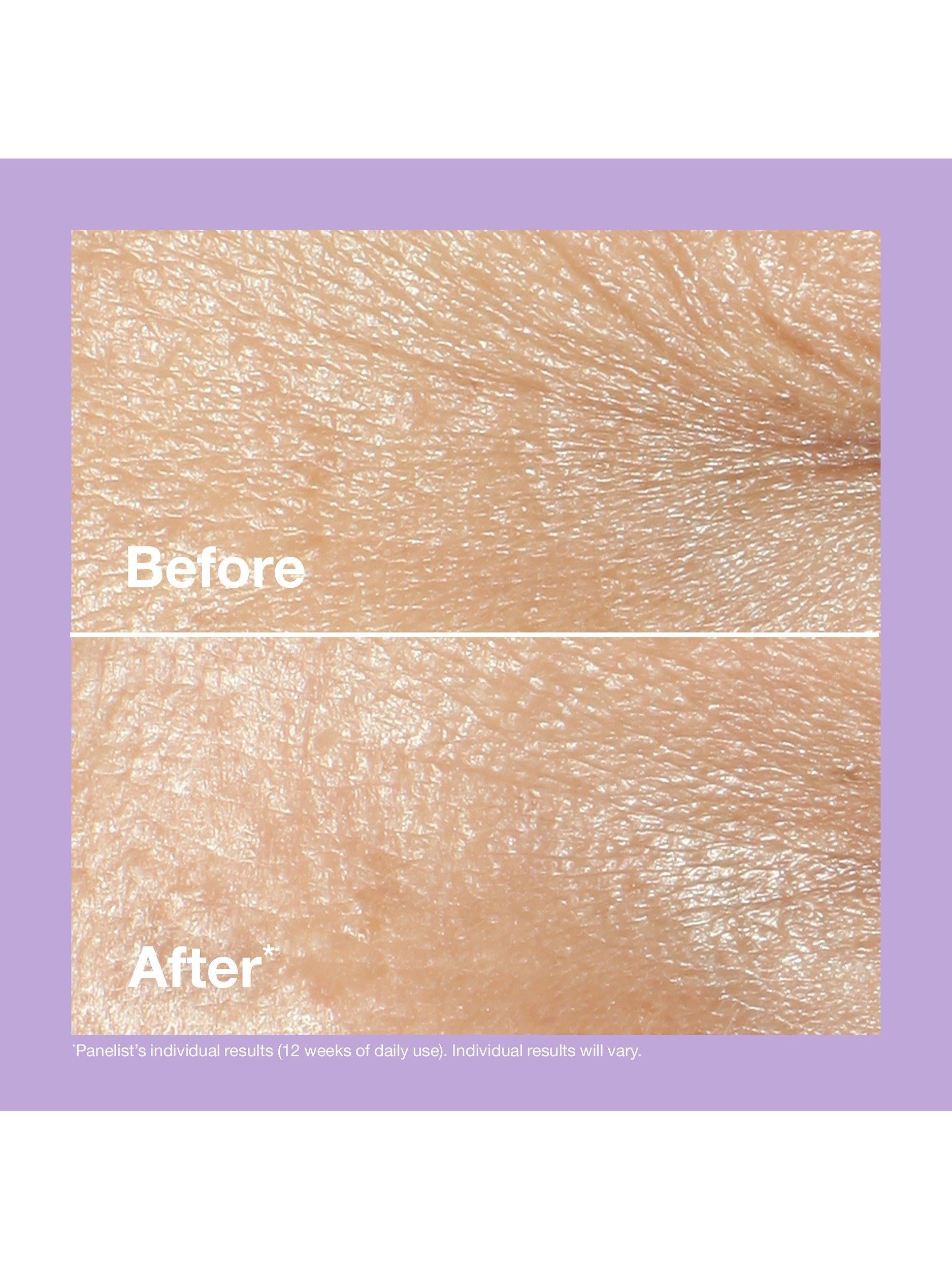 Smart Clinical Repair™ Wrinkle Correcting Cream
