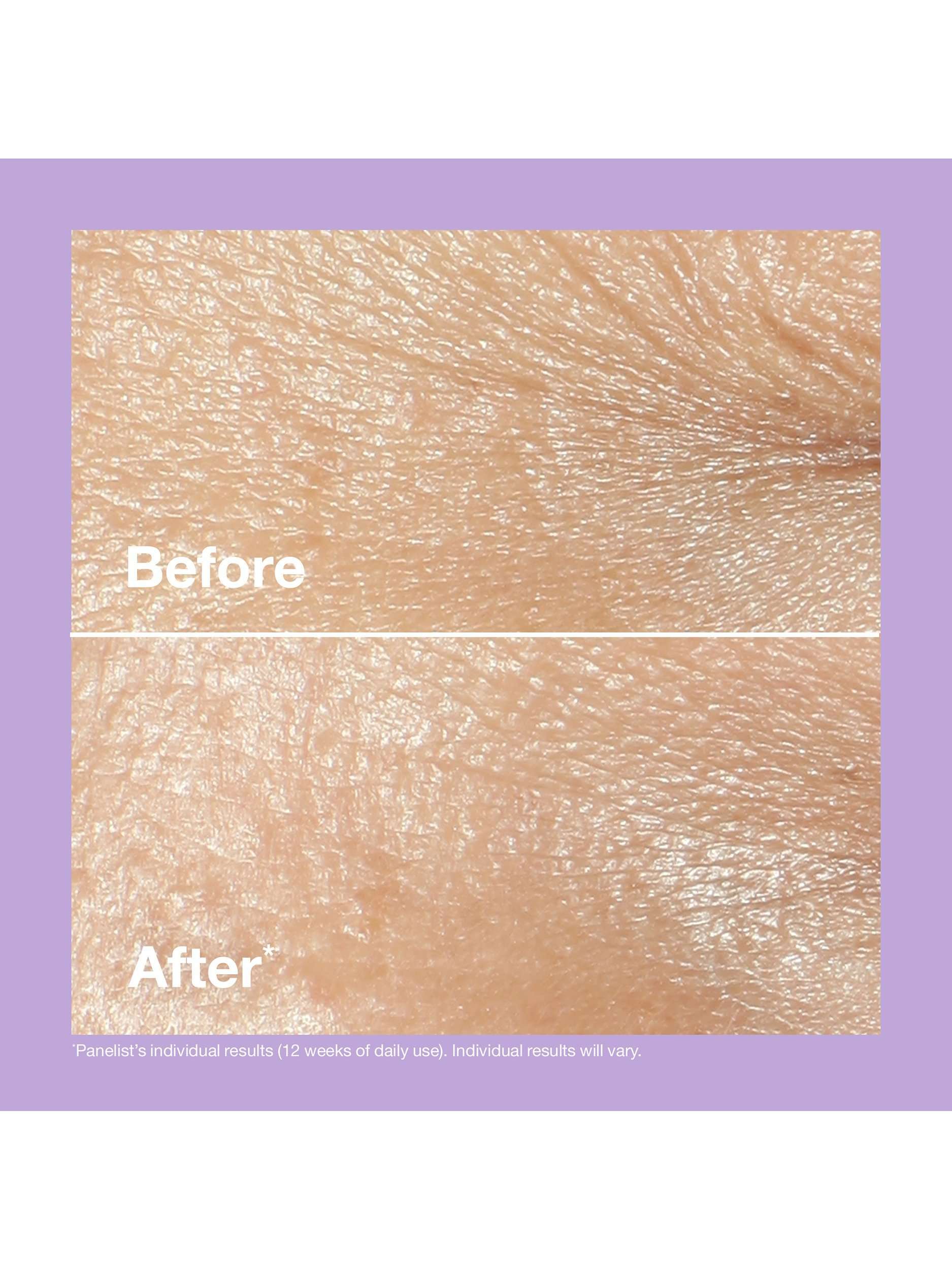 Smart Clinical Repair™ Wrinkle Correcting Cream