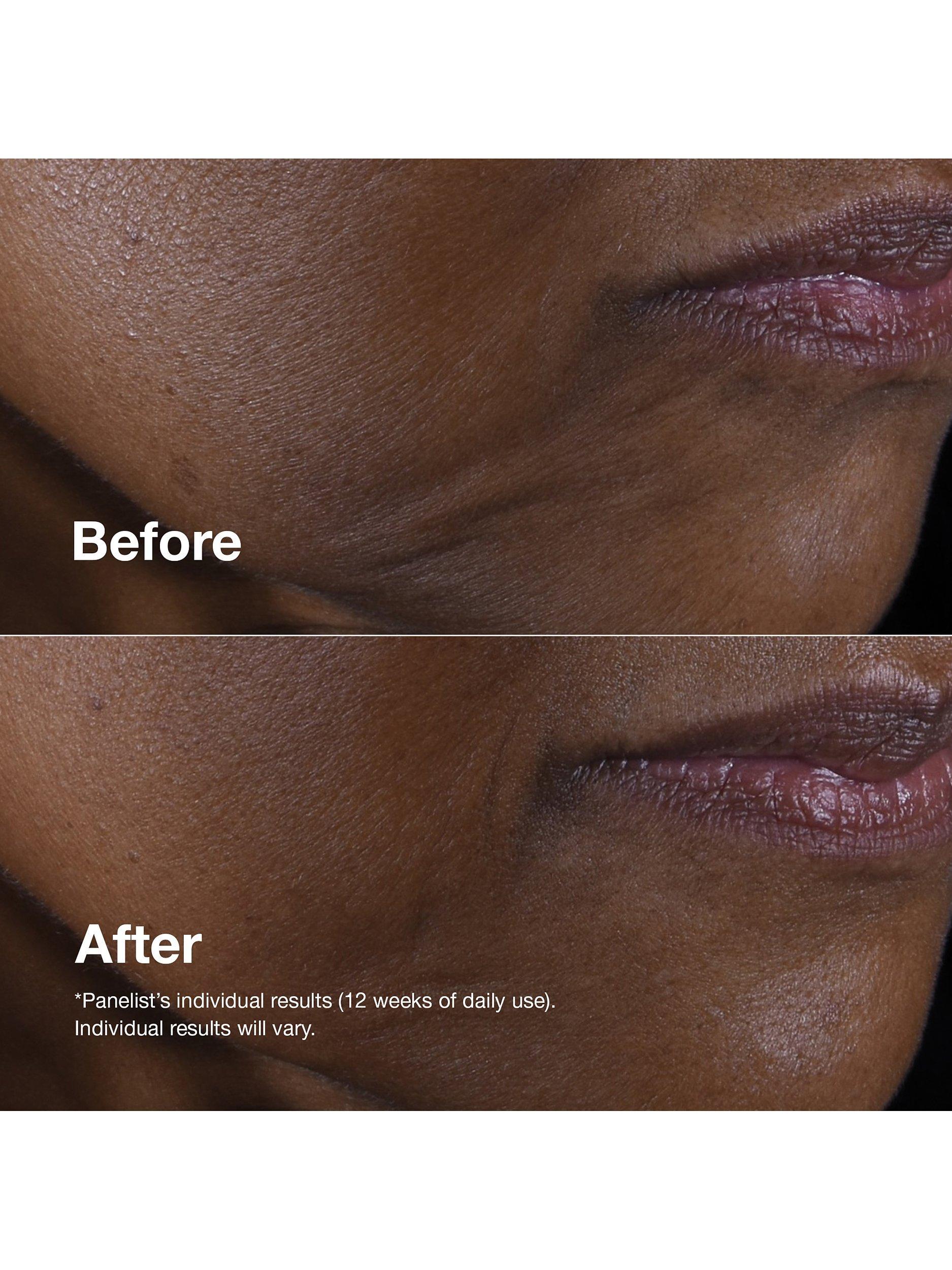 Smart Clinical Repair™ Lifting Face + Neck Cream, 50ml