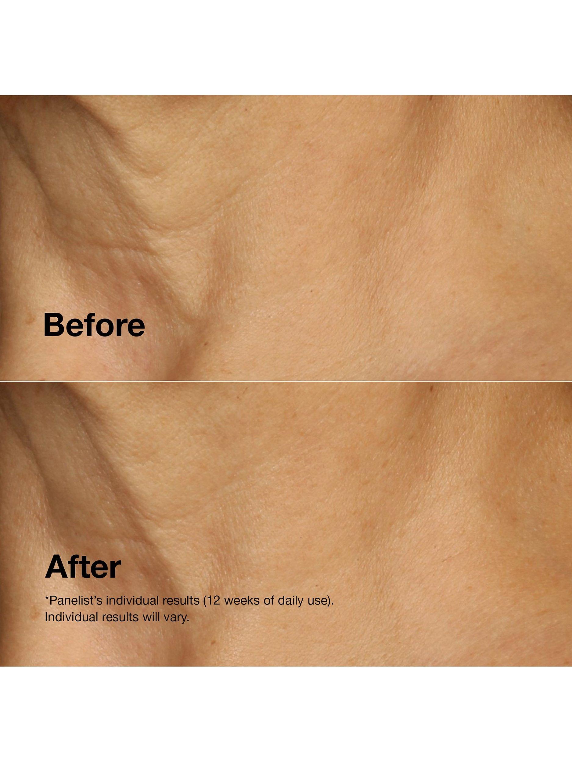 Smart Clinical Repair™ Lifting Face + Neck Cream, 50ml