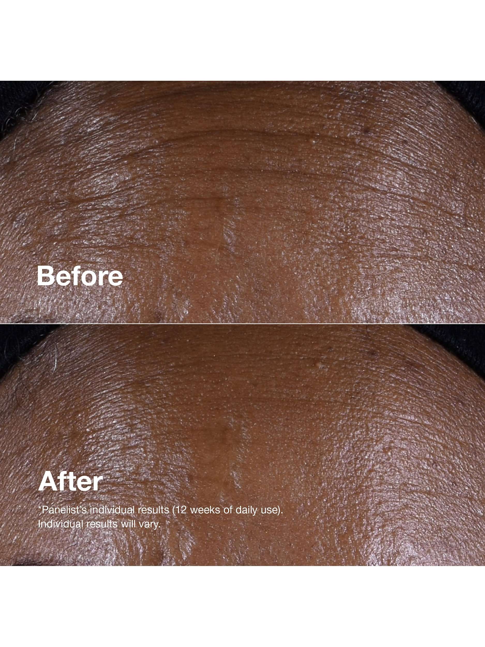 Smart Clinical Repair™ Lifting Face + Neck Cream, 50ml