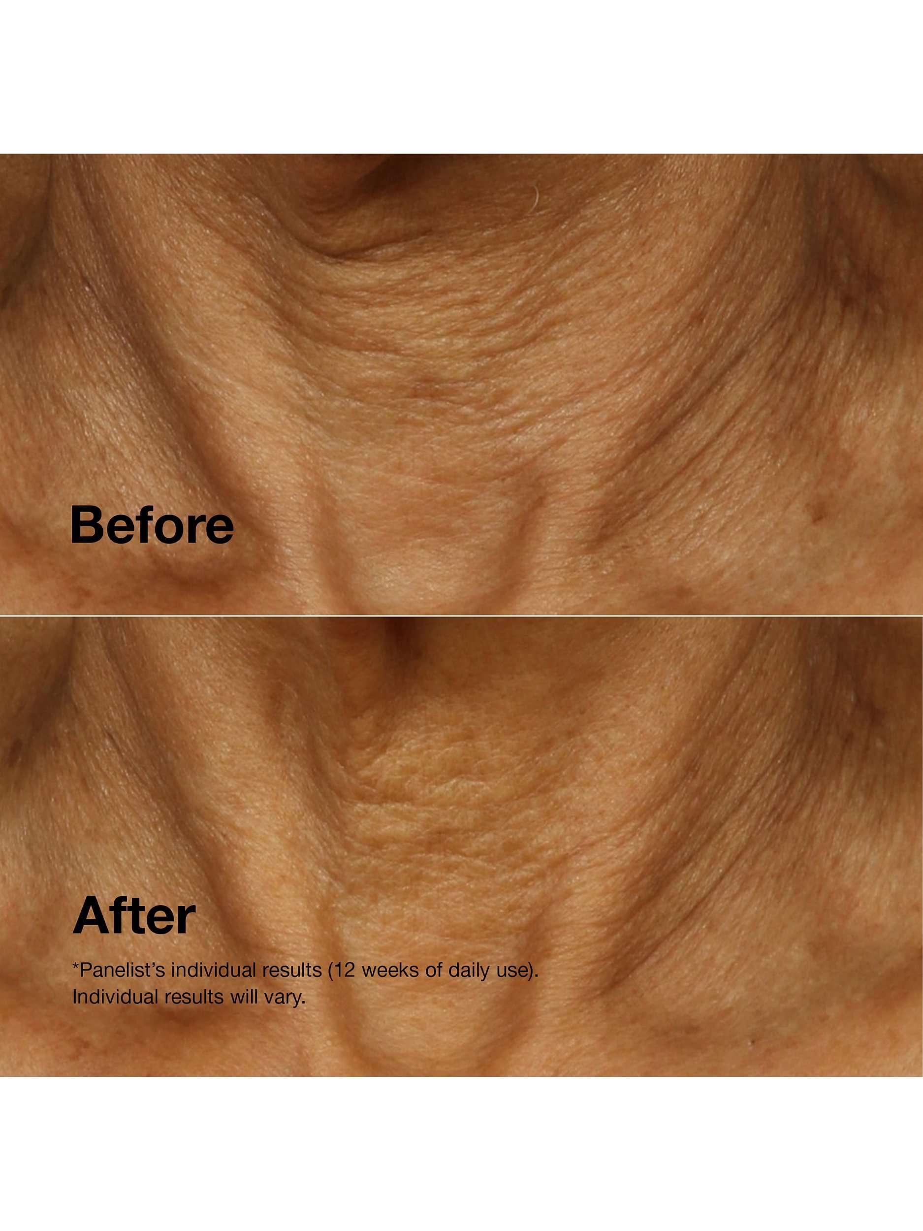 Smart Clinical Repair™ Lifting Face + Neck Cream, 50ml