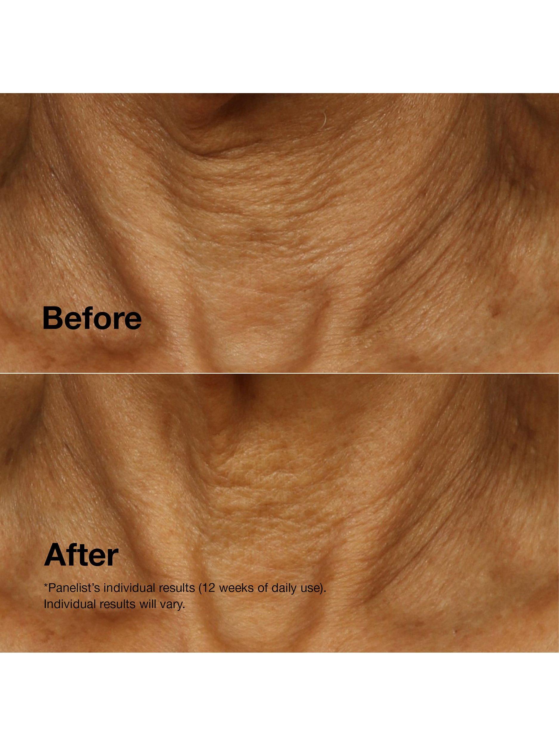 Smart Clinical Repair™ Lifting Face + Neck Cream, 50ml