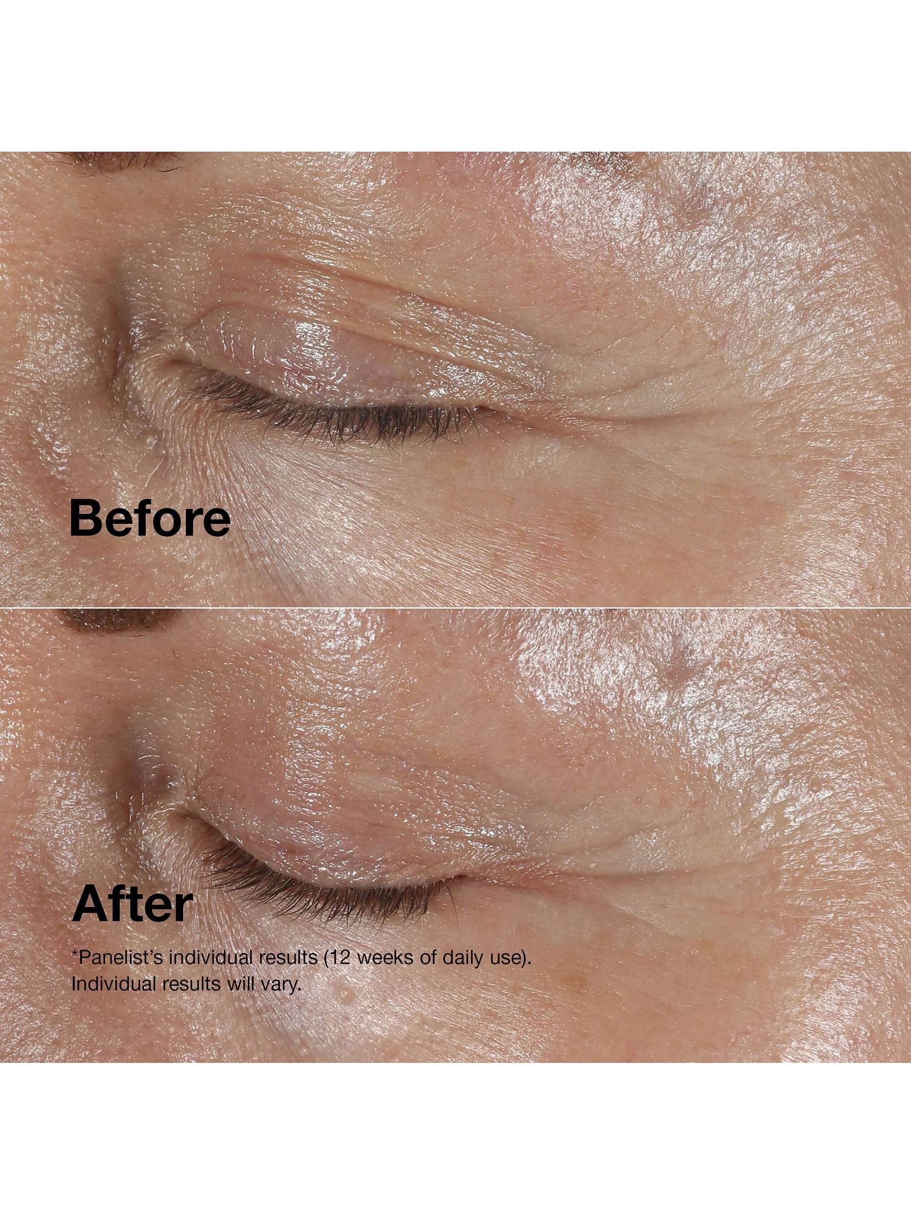 Smart Clinical Repair™ Wrinkle Correcting Eye Cream