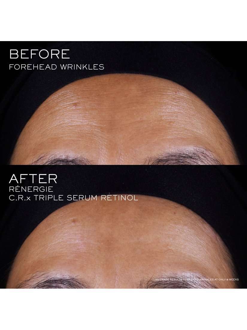 Rénergie C.R.X Triple Serum Retinol