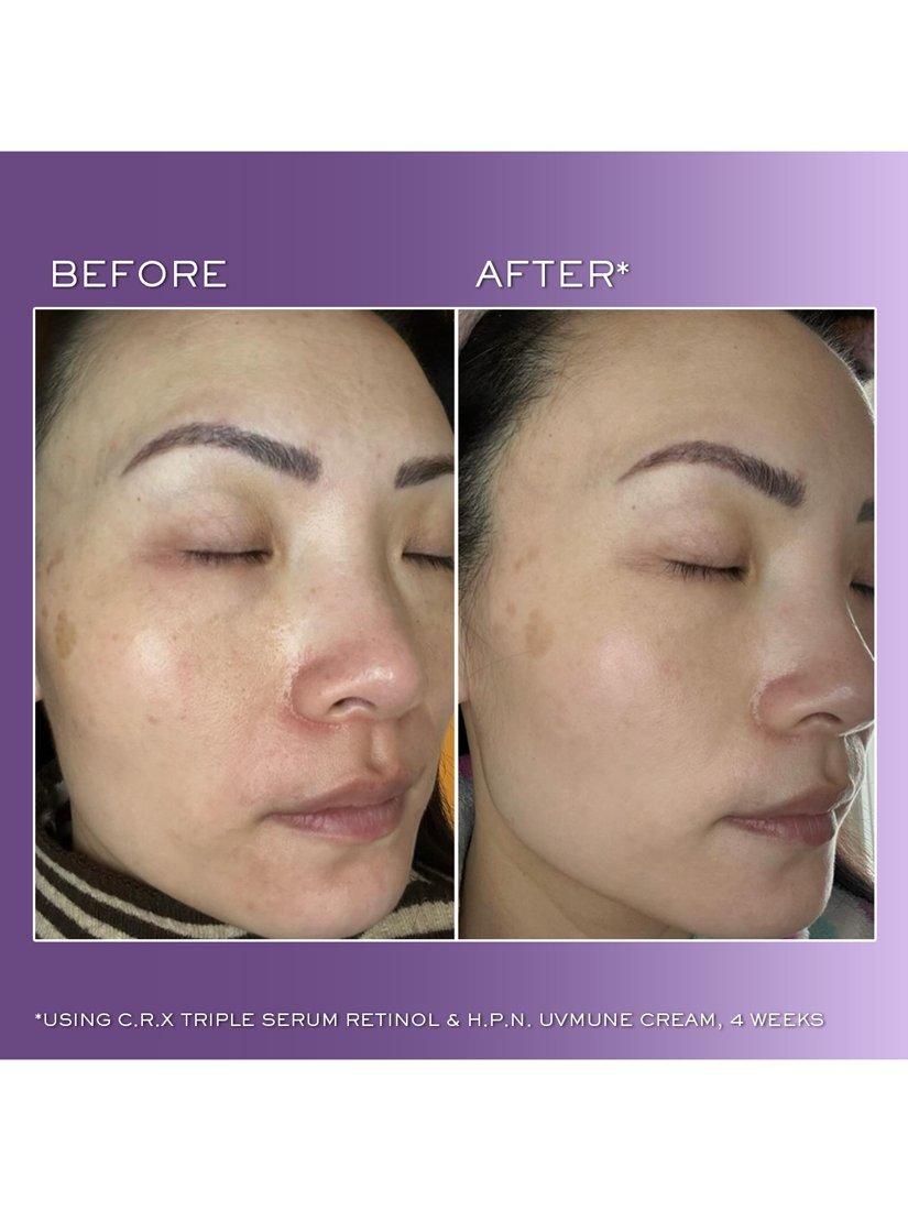 Rénergie C.R.X Triple Serum Retinol