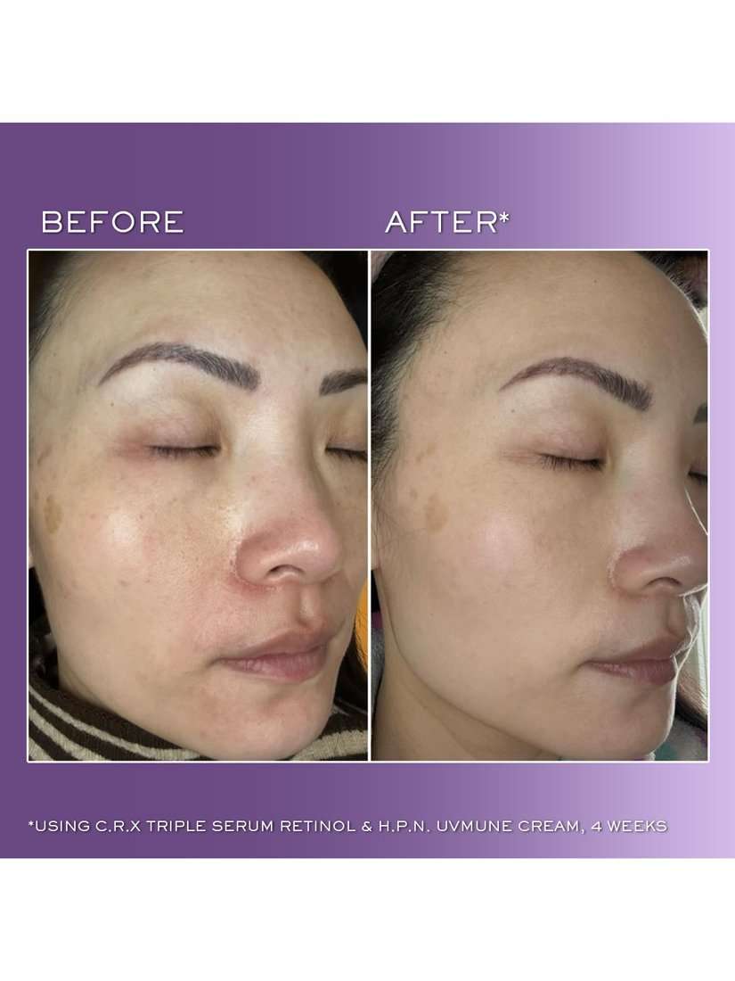 Rénergie C.R.X Triple Serum Retinol