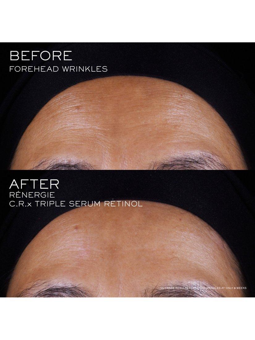 Rénergie C.R.X Triple Serum Retinol