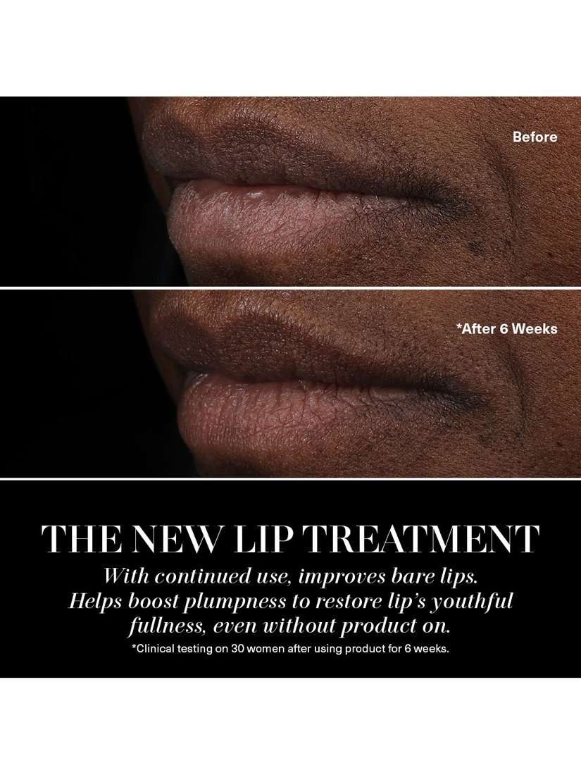 The Lip Treatment
