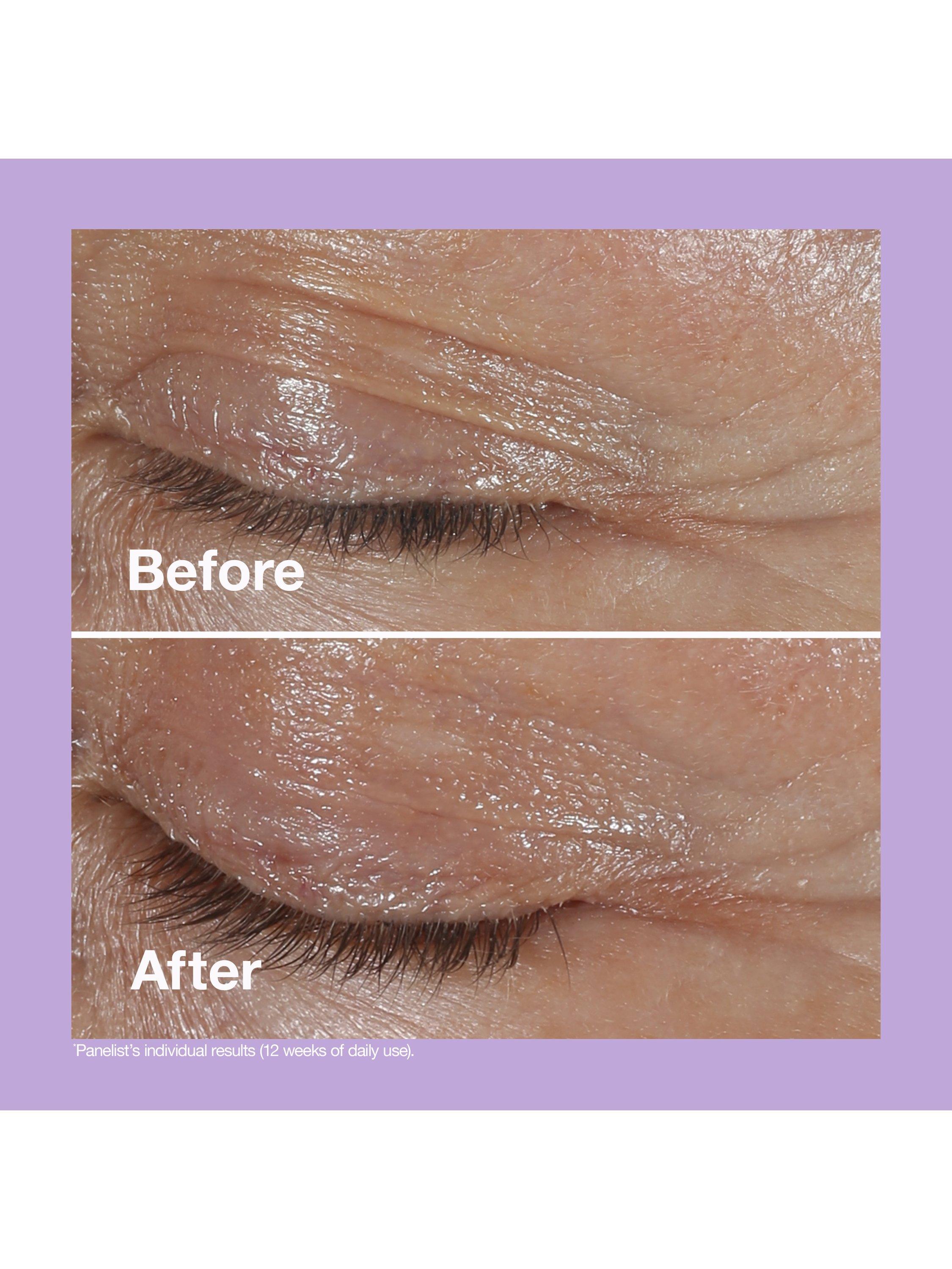 Smart Clinical Repair™ Wrinkle Correcting Eye Cream, 30ml