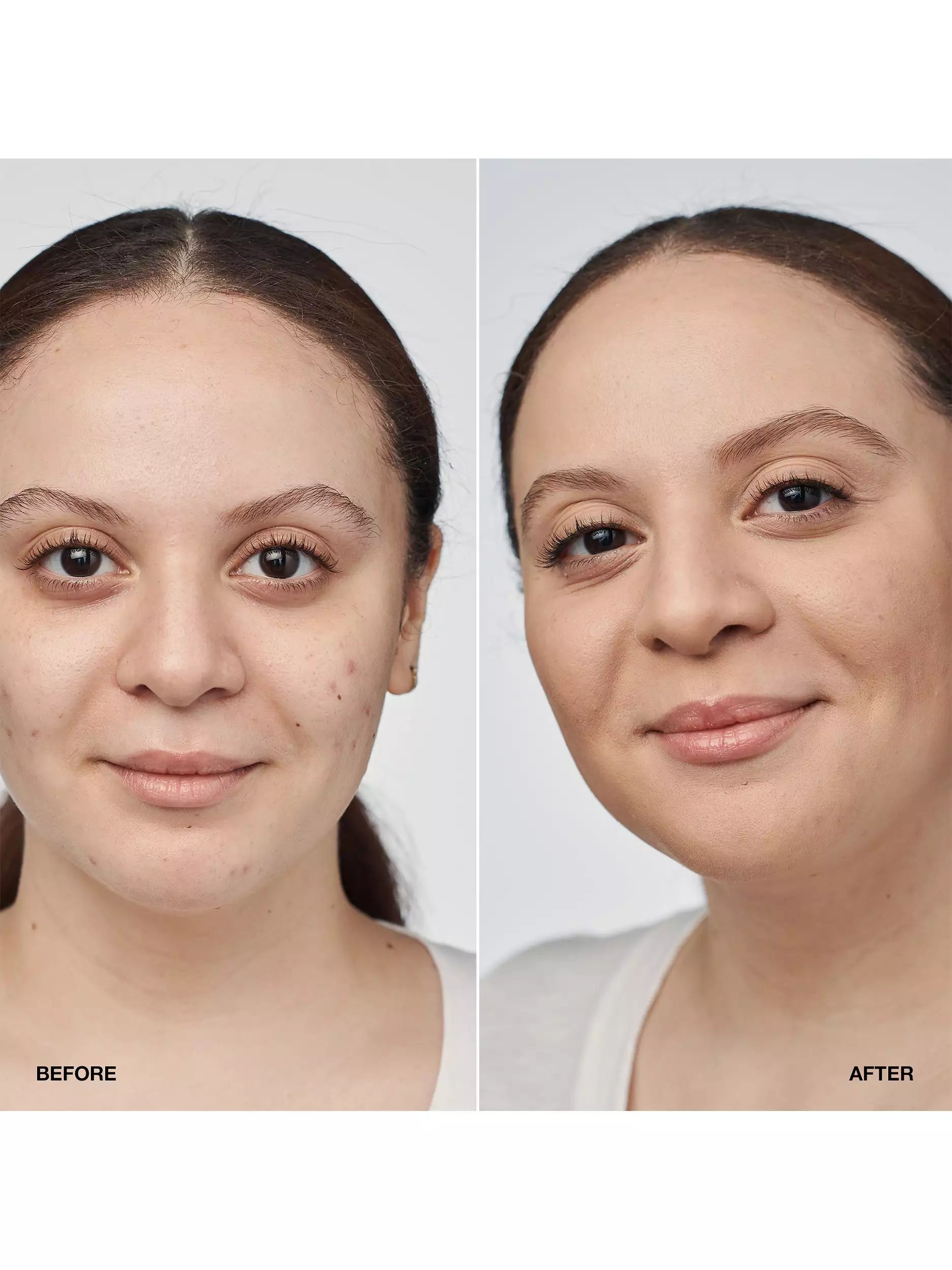 Clinique Even Better Clinical Serum Foundation SPF 20