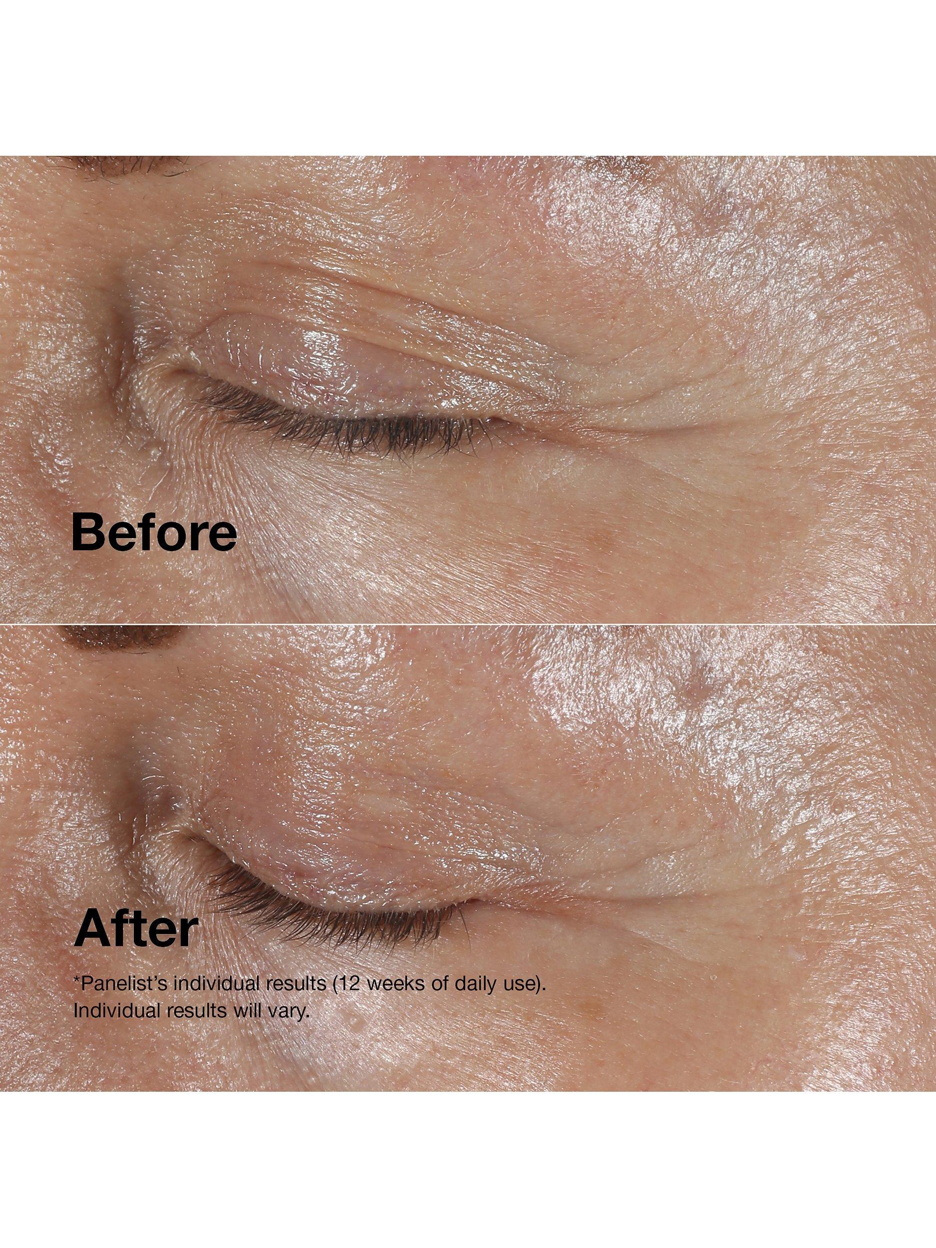 Smart Clinical Repair™ Wrinkle Correcting Eye Cream